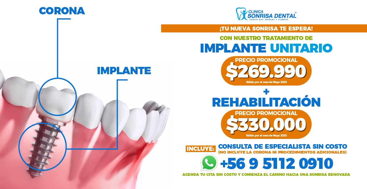 Clinica Sonrisa Dental - Banner Web 1 (5)