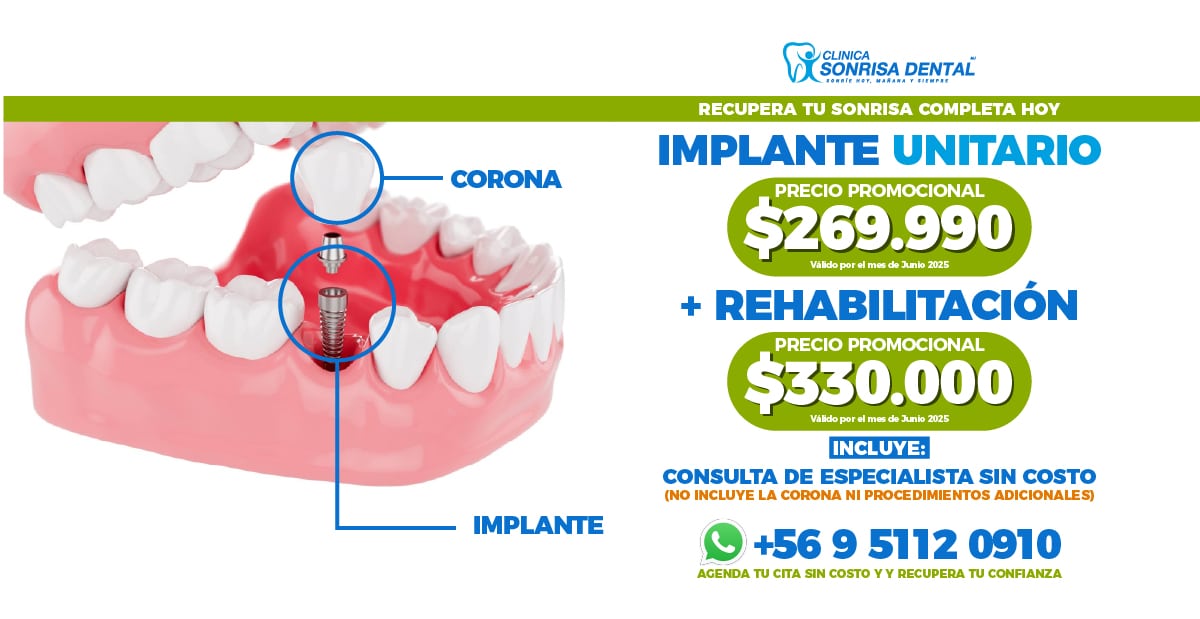 Clinica Sonrisa Dental - Banner Web 1 (6)