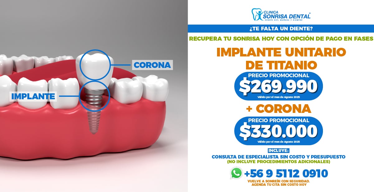 Clinica Sonrisa Dental - Banner Web 5 (7)